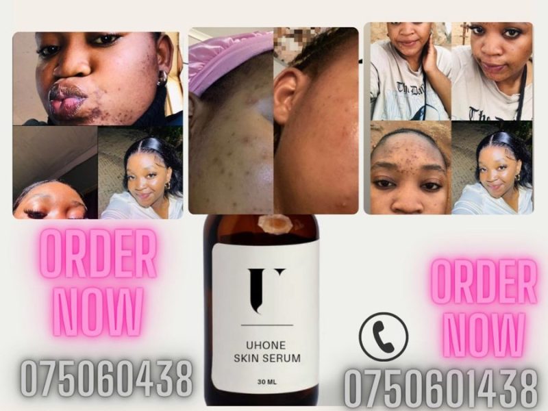 UHONE SKIN CARE